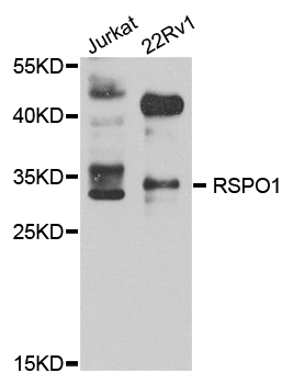 RSPO1/RSPO Antibody