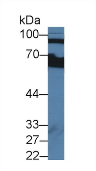 CFB/Complement Factor B Antibody