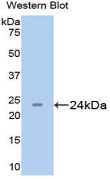 GREM1/Gremlin-1 Antibody