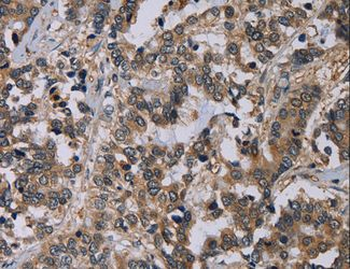 PVRL4/Nectin 4 Antibody