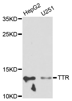TTR/Transthyretin Antibody