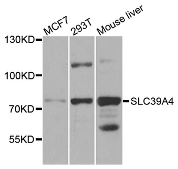 SLC39A4/ZIP4 Antibody