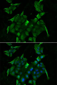 SLC34A1/NPT2 Antibody