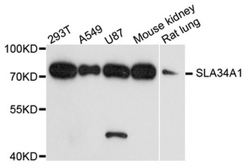 SLC34A1/NPT2 Antibody