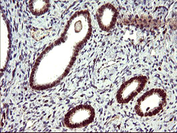 IL10RA Antibody