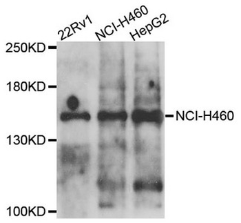 COL4A5/Collagen IV Alpha5 Antibody