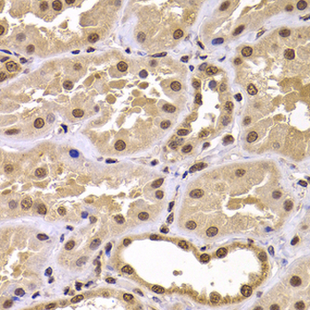 CSRP2BP Antibody