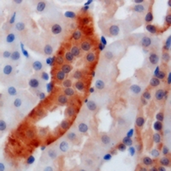 GATM/AGAT Antibody