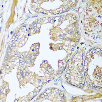 CFD/Factor D/Adipsin Antibody
