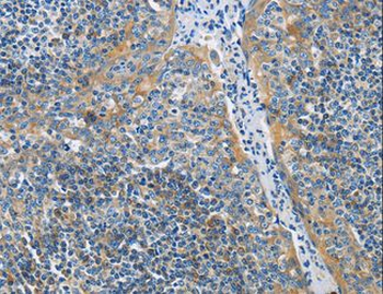 BTLA/CD272 Antibody