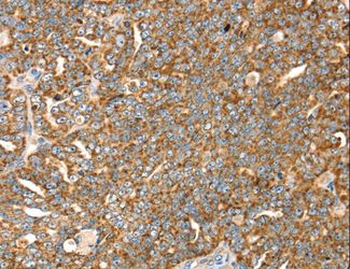 SLC8A3/NCX3 Antibody