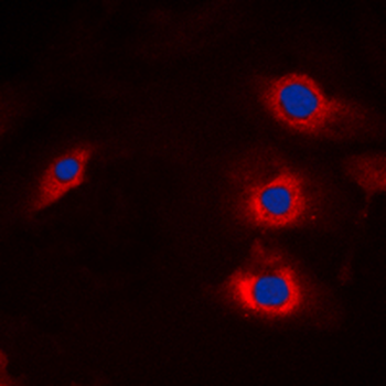 NEDL2/HECW2 Antibody