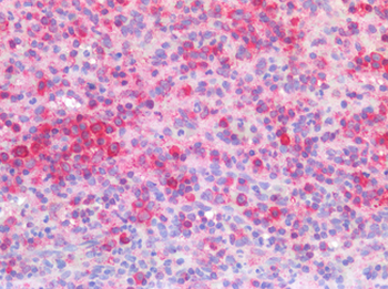 IFNAR1/IFNAR Antibody