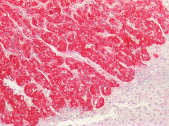 GREM1/Gremlin-1 Antibody