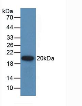 GREM1/Gremlin-1 Antibody