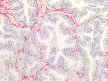 COL3A1/Collagen III Antibody