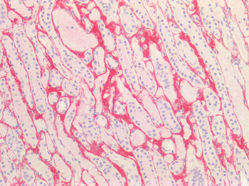 COL3A1/Collagen III Antibody