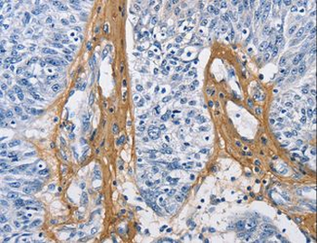 COL3A1/Collagen III Antibody