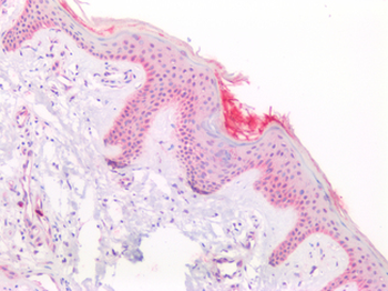 LCN2/Lipocalin 2/NGAL Antibody