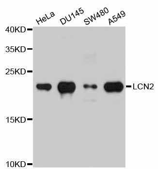 LCN2/Lipocalin 2/NGAL Antibody