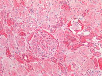 CSNK1A1/CK1 Alpha Antibody