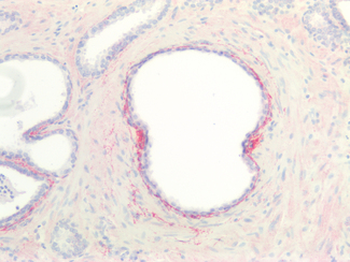 COL8A1/Collagen VIII Alpha 1 Antibody