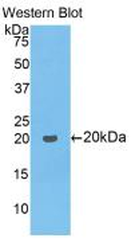 COL8A1/Collagen VIII Alpha 1 Antibody