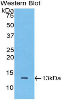 CTNNBIP1/ICAT Antibody