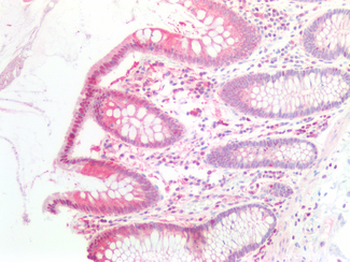 IL6ST/CD130/gp130 Antibody