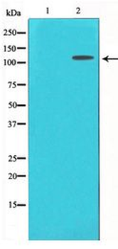 IL6ST/CD130/gp130 Antibody