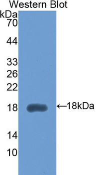 HEXB Antibody