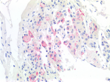 TBXT/T/Brachyury Antibody