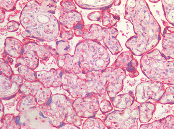 ACVR2/ACVR2A Antibody