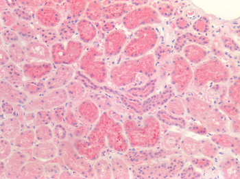 TTR/Transthyretin Antibody