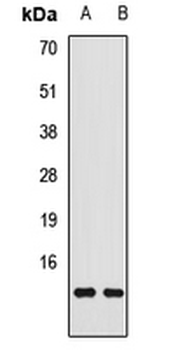 TTR/Transthyretin Antibody