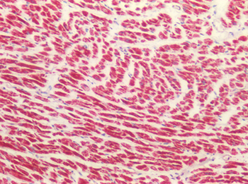 MAOB/Monoamine Oxidase B Antibody