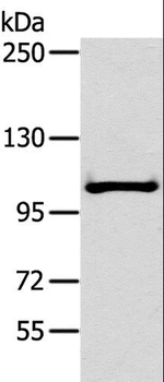 NPRB/NPR2 Antibody