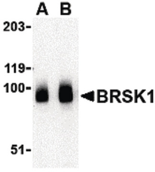 KIAA1811/BRSK1 Antibody