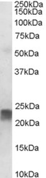 TAGLN/Transgelin/SM22 Antibody