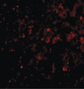 DRAM1/DRAM Antibody