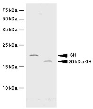 GH/Growth Hormone Antibody