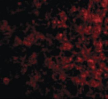 CRLF2/TSLPR Antibody