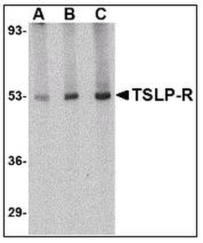 CRLF2/TSLPR Antibody