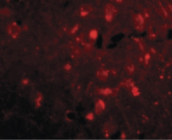 SLITRK2 Antibody