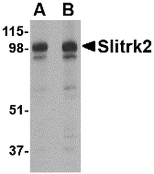 SLITRK2 Antibody