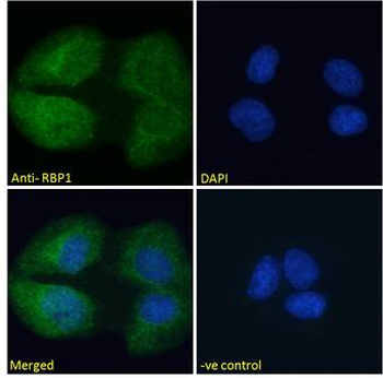 RBP1/CRBP Antibody