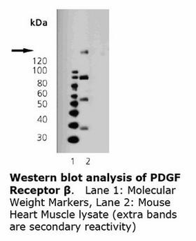 PDGFRB/PDGFR Beta Antibody