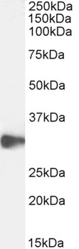 CLEC2D/OCIL/LLT1 Antibody