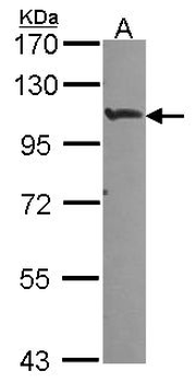 HIF2A/EPAS1 Antibody