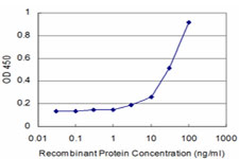 CTSK/Cathepsin K Antibody